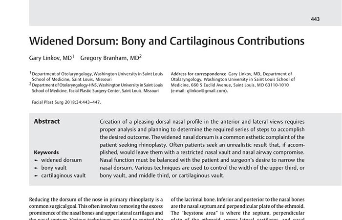 Screenshot of an article - Widened Dorsum: Bony and Cartilaginous Contributions.