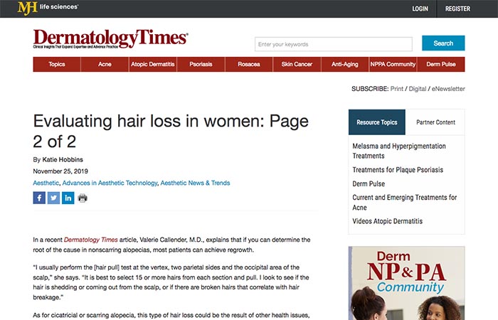 Screenshot of an article - Evaluating hair loss in women