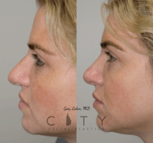 Patient result case 1