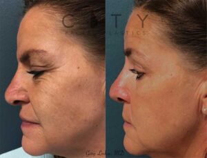 Patient Result case 2