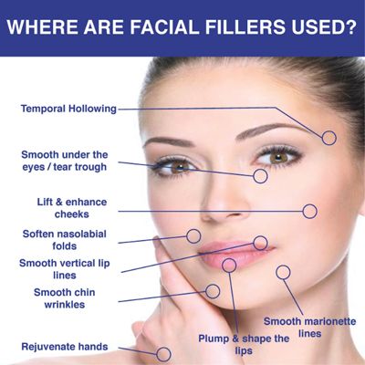 NYC Facial Fillers Dermal Injections | New York Lip Fillers | UES