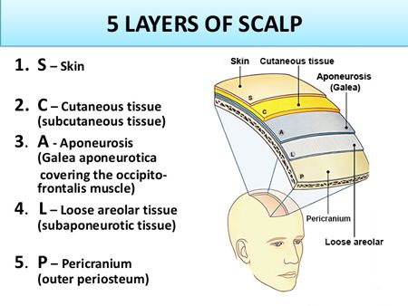 NYC Hairline Lowering/Advancement | New York Forehead Reduction