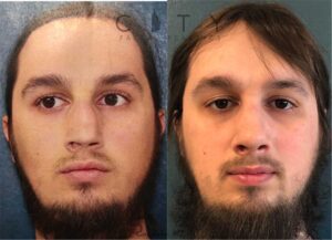 Male Plastic Surgery Rhinoplasty Case 3 | NYC City Facial Plastics