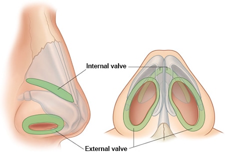 nasal vault anatomy