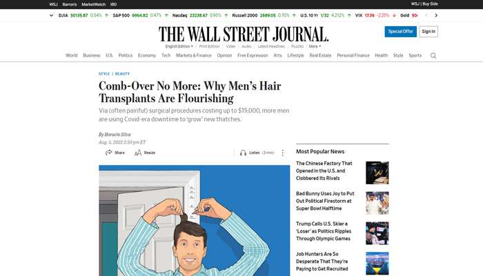 Comb-Over No More: Why Men’s Hair Transplants Are Flourishing
