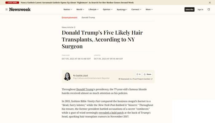 Donald Trump’s Five Likely Hair Transplants, According to NY Surgeon