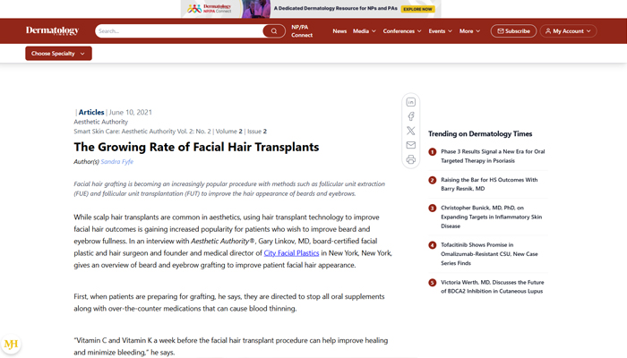 The Growing Rate of Facial Hair Transplants