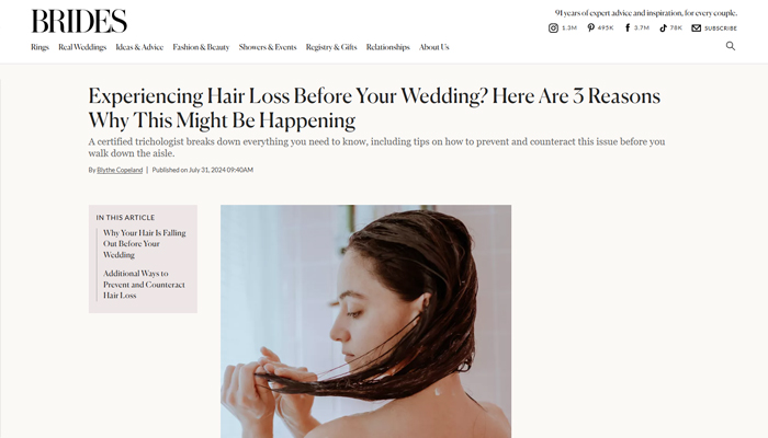 What You Can Do About Hair Loss Before Your Wedding