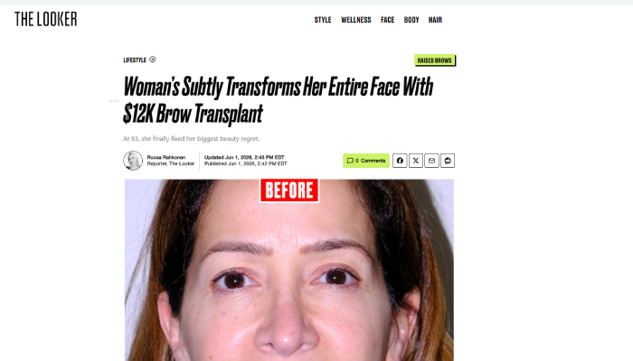 Woman’s Subtly Transforms Her Entire Face With $12K Brow Transplant