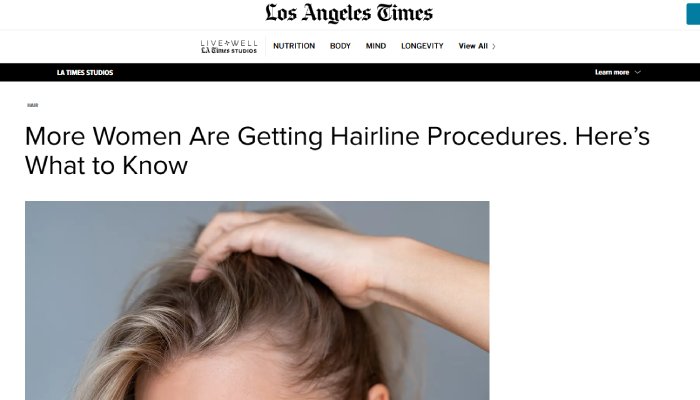 More Women Are Getting Hairline Procedures. Here’s What to Know